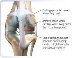 Dog Arthritis